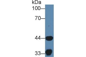 Detection of HADH in Porcine Skeletal muscle lysate using Polyclonal Antibody to Hydroxyacyl Coenzyme A Dehydrogenase (HADH)