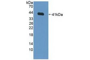 Detection of Recombinant FNTa, Human using Polyclonal Antibody to Farnesyltransferase Alpha (FNTa) (FNTA 抗体  (AA 51-366))