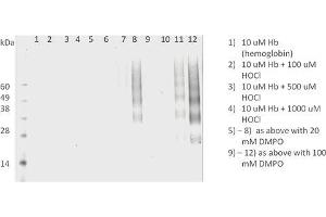 Western Blot analysis of Human HL 60 clone 15 eosinophils lysates showing detection of DMPO protein using Mouse Anti-DMPO Monoclonal Antibody, Clone N1664A (ABIN2482169).