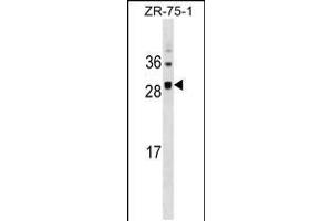 Western blot analysis in ZR-75-1 cell line lysates (35ug/lane). (SPC25 抗体  (AA 87-114))