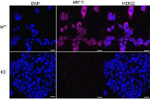 anti-ATP-Binding Cassette, Sub-Family D (Ald), Member 1 (ABCD1) antibody