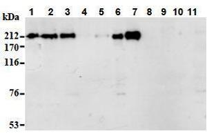 Western Blotting (WB) image for anti-Apoptotic Chromatin Condensation Inducer 1 (ACIN1) (AA 1-523), (N-Term) antibody (ABIN1105223) (ACIN1 抗体  (N-Term))