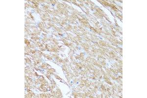 Immunohistochemistry of paraffin-embedded mouse heart using CYCS antibody.