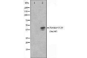 Western blot analysis on Jurkat cell lysate using Phospho-CCR5(Ser349) Antibody. (CCR5 抗体  (pSer349))