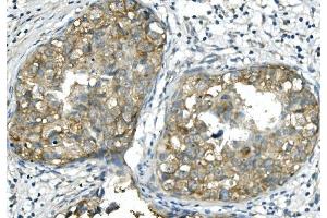 IHC analysis of BubR1/BUB1B using anti-BubR1/BUB1B antibody (ABIN7600960). (BUB1B 抗体  (AA 26-448))