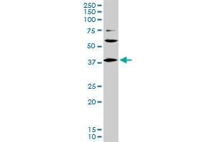 LHX6 monoclonal antibody (M01), clone 3D9. (LHX6 抗体  (AA 274-363))
