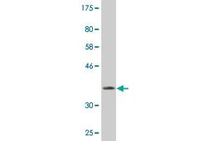 Western Blot detection against Immunogen (37.