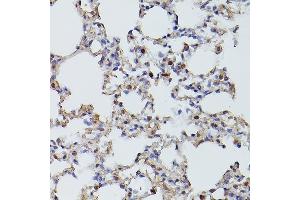 Immunohistochemistry (IHC) image for anti-Tet Methylcytosine Dioxygenase 3 (TET3) (AA 1525-1660) antibody (ABIN6149021)