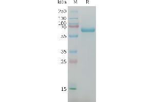 SDS-PAGE (SDS) image for alpha-Fetoprotein (AFP) (AA 21-605) protein (His tag) (ABIN7538129)