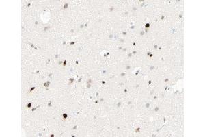 ABIN6267413 at 1/100 staining human brain tissue sections by IHC-P. (CEBPB 抗体  (pThr235))