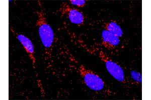 Proximity Ligation Analysis of protein-protein interactions between HNF4A and CTNNB1. (HNF4A 抗体  (AA 1-464))