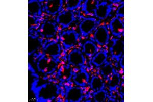 Immunofluorescence (Paraffin-embedded Sections) (IF (p)) image for anti-Src Homology 2 Domain Containing F (SHF) antibody (ABIN7075710)