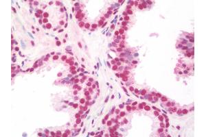 Anti-NELFA / WHSC2 antibody IHC staining of human prostate. (WHSC2 抗体  (AA 280-511))
