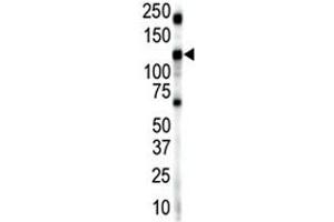 Western blot analysis of Insulin receptor-related antibody and mouse brain lysate. (INSRR 抗体  (AA 16-47))
