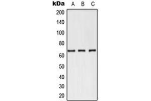 Western blot analysis of CD62E expression in PC12 (A), NIH3T3 (B), Jurkat (C) whole cell lysates. (Selectin E/CD62e 抗体  (N-Term))