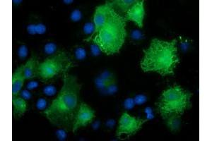 Immunofluorescence (IF) image for anti-Calcium Binding and Coiled-Coil Domain 2 (CALCOCO2) antibody (ABIN1497076) (CALCOCO2 抗体)