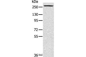 Western blot analysis of Huvec cell, using TLN1 Polyclonal Antibody at dilution of 1:200 (TLN1 抗体)