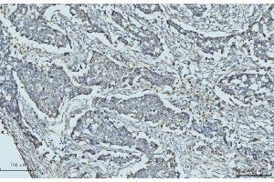IHC analysis of Cytokeratin 5 using anti-Cytokeratin 5 antibody (ABIN7602992). (Cytokeratin 5 抗体  (Middle Region))