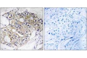 Immunohistochemistry (IHC) image for anti-Dehydrogenase/reductase (SDR Family) Member 4 (DHRS4) (AA 191-240) antibody (ABIN2890257) (DHRS4 抗体  (AA 191-240))