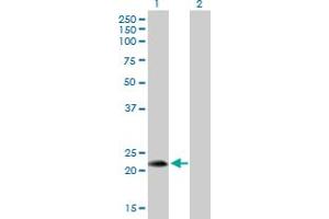 Western Blot analysis of FGF19 expression in transfected 293T cell line by FGF19 MaxPab polyclonal antibody. (FGF19 抗体  (AA 1-216))