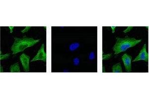 IF analysis of Hela with antibody (Left) and DAPI (Right) diluted at 1:100. (TUBB3 抗体)
