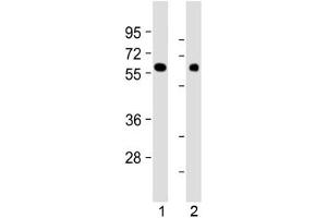 Western blot testing of human 1) kidney and 2) lung tissue lysate with MKS1 antibody at 1:2000. (MKS1 抗体  (N-Term))