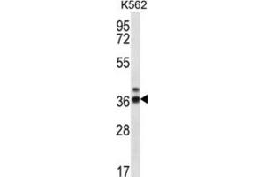 Western Blotting (WB) image for anti-Ribonuclease P/MRP 38kDa Subunit (RPP38) antibody (ABIN2996921) (RPP38 抗体)