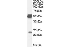 Western Blotting (WB) image for anti-Neurturin (NRTN) (AA 176-191) antibody (ABIN292886) (Neurturin 抗体  (AA 176-191))