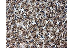 Immunohistochemistry (IHC) image for anti-ATP Synthase, H+ Transporting, Mitochondrial F1 Complex, beta Polypeptide (ATP5B) antibody (ABIN2716440)