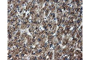 Immunohistochemical staining of paraffin-embedded liver tissue using anti-ATP5Bmouse monoclonal antibody. (ATP5B 抗体)