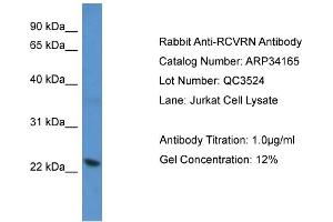 WB Suggested Anti-RCVRN Antibody   Titration: 1. (Recoverin 抗体  (C-Term))