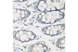 Immunohistochemistry of paraffin-embedded human colon using TNNC2 antibody at dilution of 1:200 (40x lens). (TNNC2 抗体)