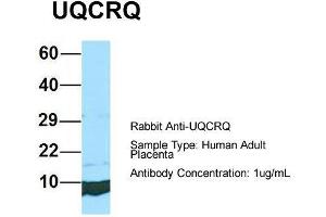 Host: Rabbit  Target Name: UQCRQ  Sample Tissue: Human Adult Placenta  Antibody Dilution: 1. (UQCRQ 抗体  (Middle Region))