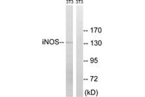 Western blot analysis of extracts from NIH-3T3 cells, using iNOS (Ab-151) Antibody. (NOS2 抗体  (AA 117-166))