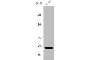 Western Blot analysis of COLO205 cells using Sam 68 Polyclonal Antibody (KHDRBS1 抗体  (Internal Region))