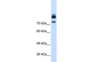 Western Blotting (WB) image for anti-Myotubularin Related Protein 1 (MTMR1) antibody (ABIN2462536) (MTMR1 抗体)