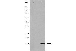 Western blot analysis of Interleukin 5 expression in HT-29 cells,The lane on the left is treated with the antigen-specific peptide. (IL-5 抗体  (Internal Region))