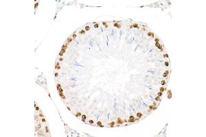 Immunohistochemistry (IHC) image for anti-Proliferating Cell Nuclear Antigen (PCNA) antibody (ABIN6139020)