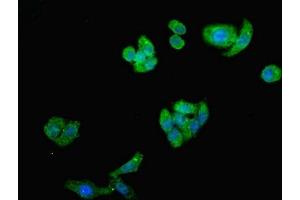 Immunofluorescent analysis of HepG2 cells using ABIN7143802 at dilution of 1:100 and Alexa Fluor 488-congugated AffiniPure Goat Anti-Rabbit IgG(H+L) (ST8SIA2 抗体  (AA 24-160))