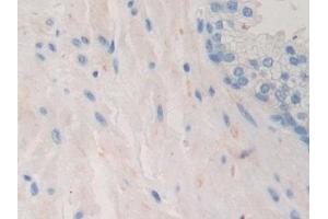 Immunohistochemistry (IHC) image for anti-Pyruvate Dehydrogenase Complex, Component X (PDHX) (AA 220-468) antibody (ABIN7443305)