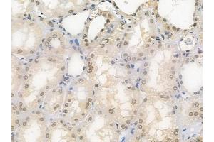 ABIN6258035 and ABIN6275789 at 1/100 staining human normal kidney tissue by IHC-P. (CSRNP2 抗体  (Internal Region))