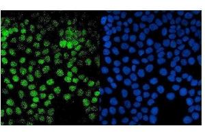 IF analysis of PTF1A using anti-PTF1A antibody (ABIN7599226).