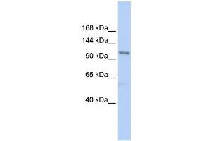 TRPC3 antibody used at 1 ug/ml to detect target protein. (TRPC3 抗体  (N-Term))