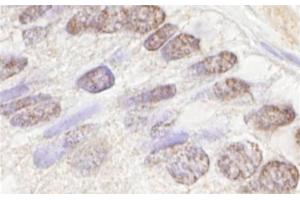 Immunohistochemistry (IHC) image for anti-Ataxia Telangiectasia Mutated (ATM) (AA 2550-2600) antibody (ABIN7448423)