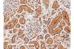 IHC testing of FFPE human kidney tissue with Arginase 1 antibody. (Liver Arginase 抗体)