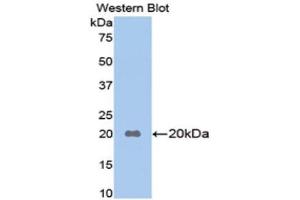 Western Blotting (WB) image for anti-Apolipoprotein B (APOB) (AA 3360-3526) antibody (ABIN1077819) (APOB 抗体  (AA 3360-3526))