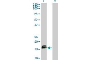 Western Blot analysis of CALM3 expression in transfected 293T cell line by CALM3 MaxPab polyclonal antibody. (Calmodulin 3 抗体  (AA 1-149))