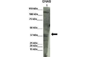Lanes :  Lane 1: INS1 lysate   Primary Antibody Dilution :   1:1000    Secondary Antibody :  Donkey anti-rabbit-HRP   Secondary Antibody Dilution :   1:1000   Gene Name :  GNAS   Submitted by :  Olivier Costa, Diabetes research center VUB (GNAS 抗体  (N-Term))