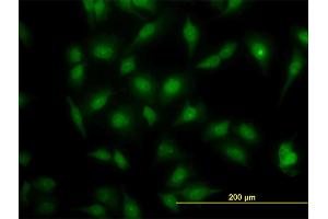 Immunofluorescence of monoclonal antibody to MAPK3 on HeLa cell. (ERK1 抗体  (AA 279-379))