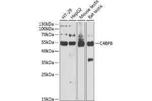 Western blot analysis of extracts of various cell lines, using C4BPB antibody (ABIN6127735, ABIN6137775, ABIN6137776 and ABIN6221978) at 1:1000 dilution. (C4BPB 抗体  (AA 18-251))